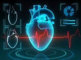 AI predicting heart attacks